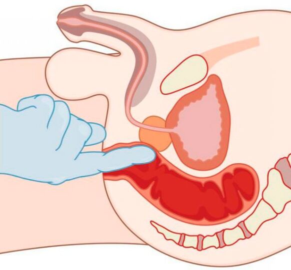 G-spot stimulation in a person through the anus